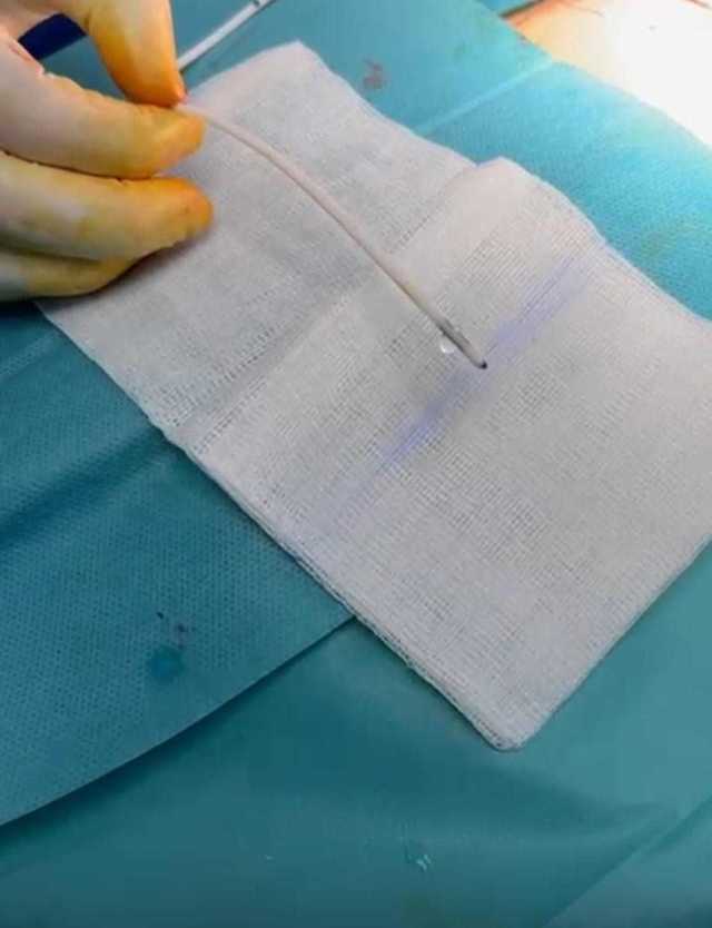 Arad: Cum a fost salvată o tânără de 21 de ani de medicii Spitalului Județean?