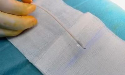 Tânăra de 21 de ani, operată 4 ore la Spitalul Județean Arad: va supraviețui?